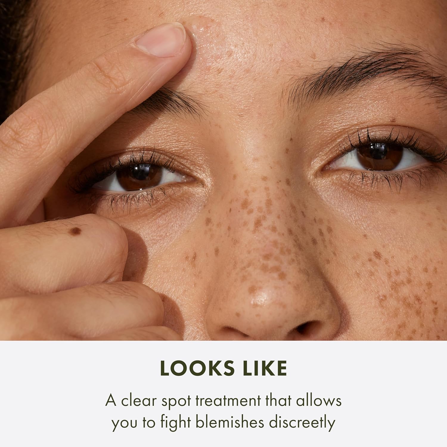 Detalle 2 de Origins Super Spot Remover Blemish Treatment Gel