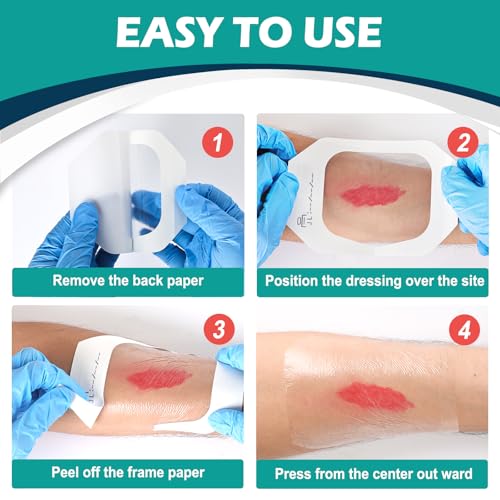 Thumbnail 6 de YHOVID Transparent Film Dressing 4" x 4.75" (Box of 30): Waterproof, Hypoallergenic Wound Care