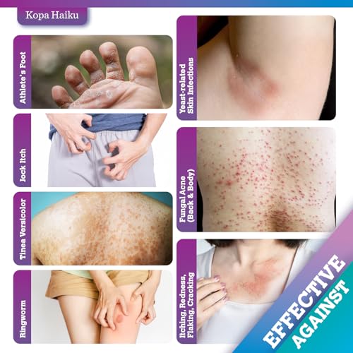 Detalle 2 de Kopa Haiku Antifungal Cream for Scalp & Body Skin (20g) – Suitable for Athletes Foot, Ringworm, Jock Itch, Tinea Versicolor & Seborrhoeic Dermatitis