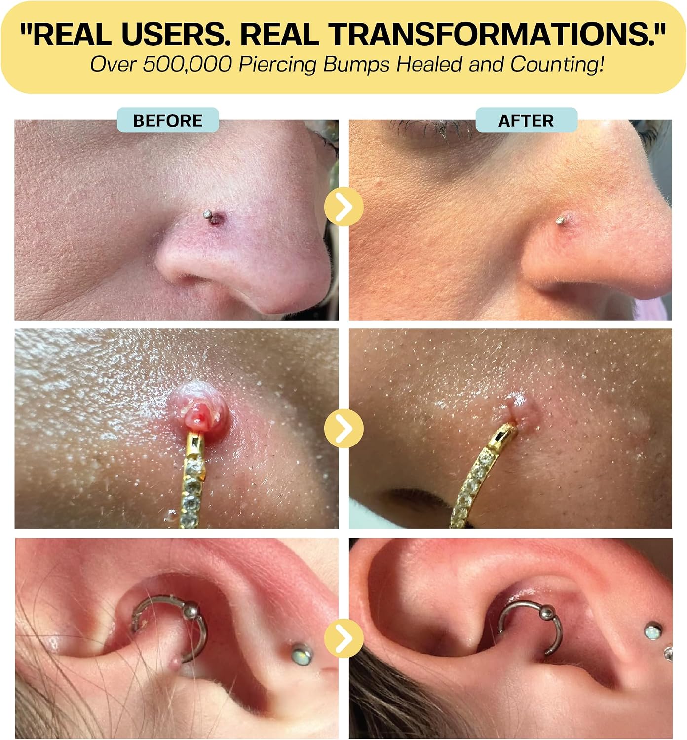Thumbnail 3 de BASE LABORATORIES Keloid Bump Removal 0.5 oz