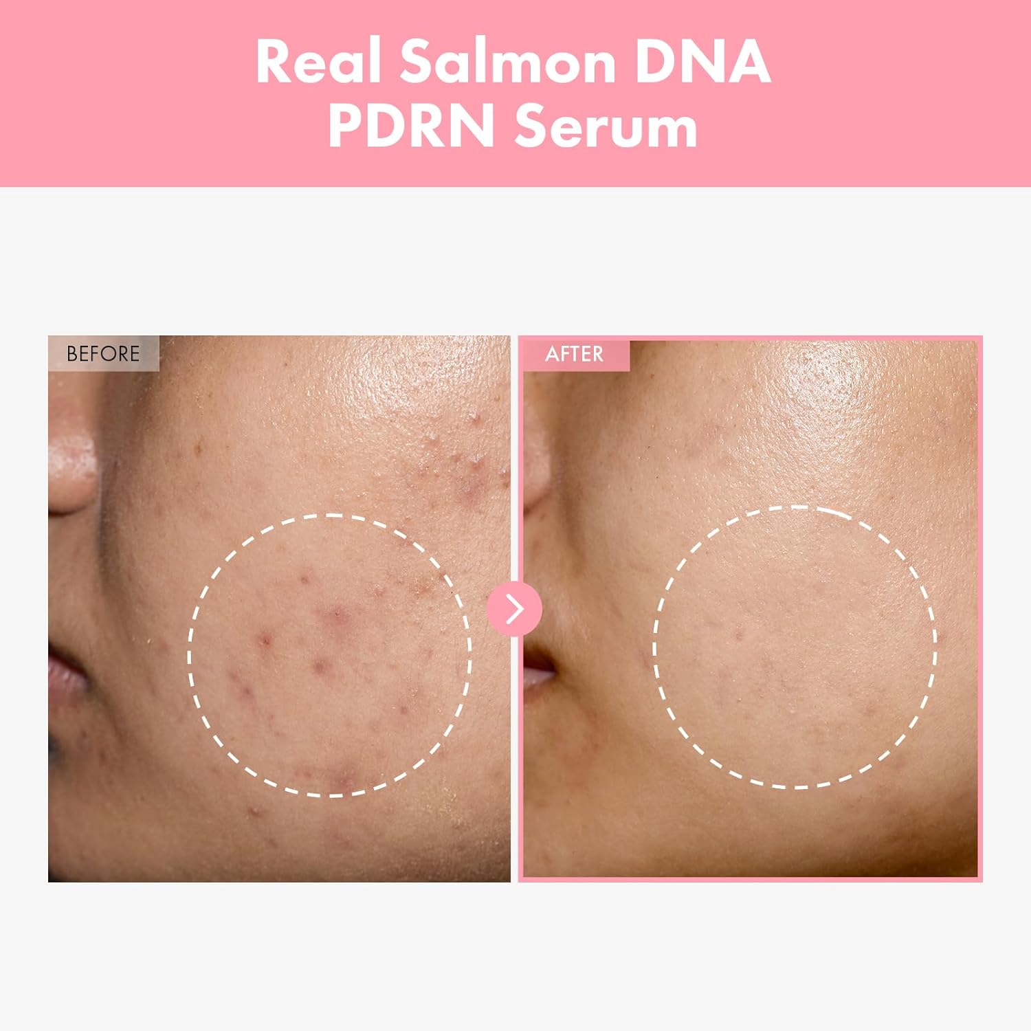 Detalle 2 de Pink Peptide 12 Serum, 12 peptides