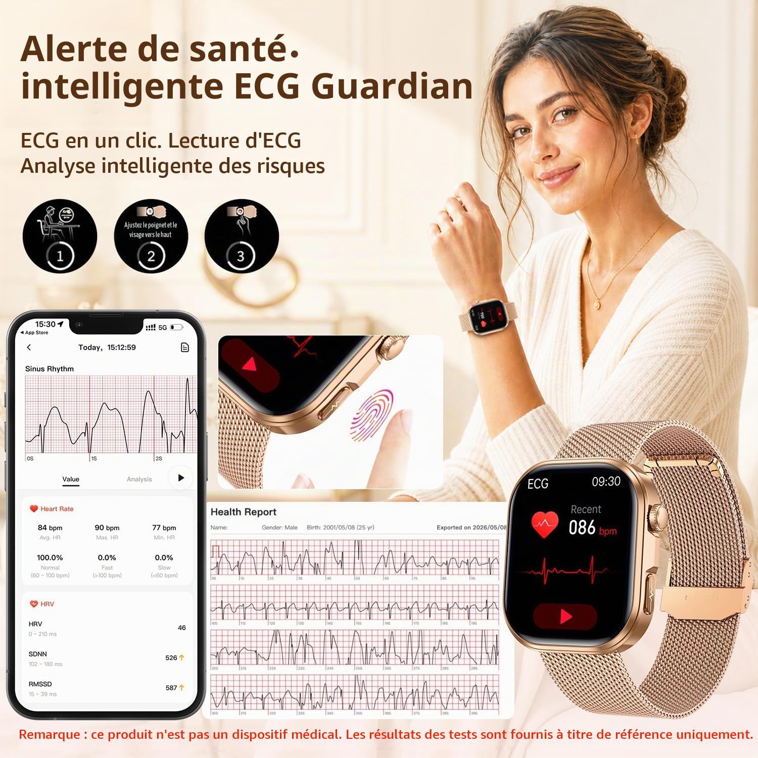 Detalle 2 de NONGAMX smartwatch 01GE52Gd voor dames met ECG, HRV en 130+ sportmodi
