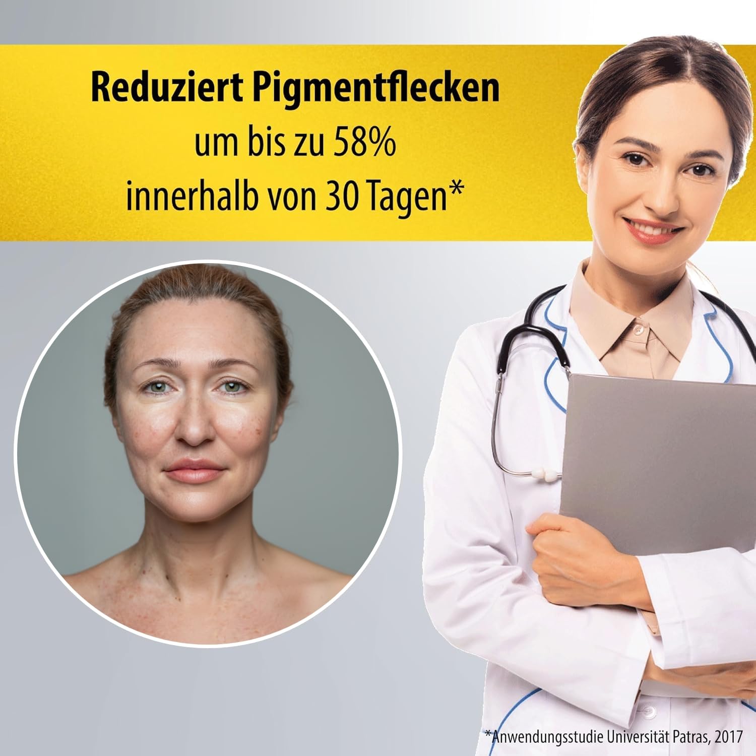 Thumbnail 1 de Evolsin EVOLSIN® Anti Pigmentflecken Creme gegen Melasma & Altersflecken für Gesicht, Hals & Dekolleté