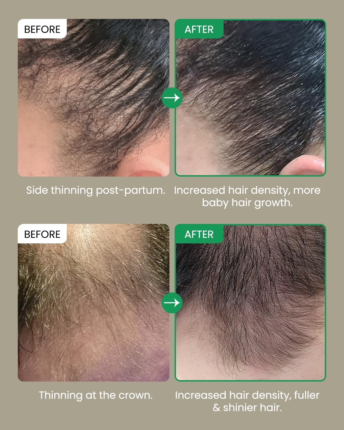 Thumbnail 6 de Yoauoop Olio di Rosmarino 50 ml per capelli