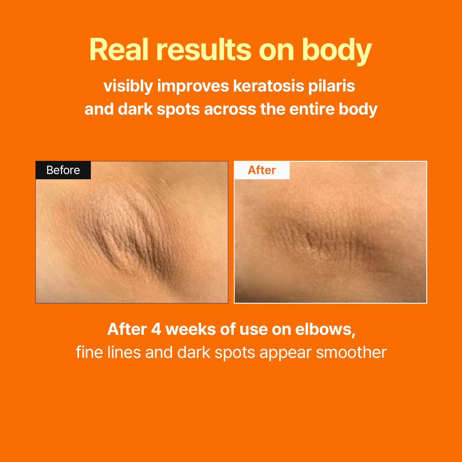 Detalle 2 de MEDITHERAPY Retinal Skin Booster 5.07 Fl.Oz