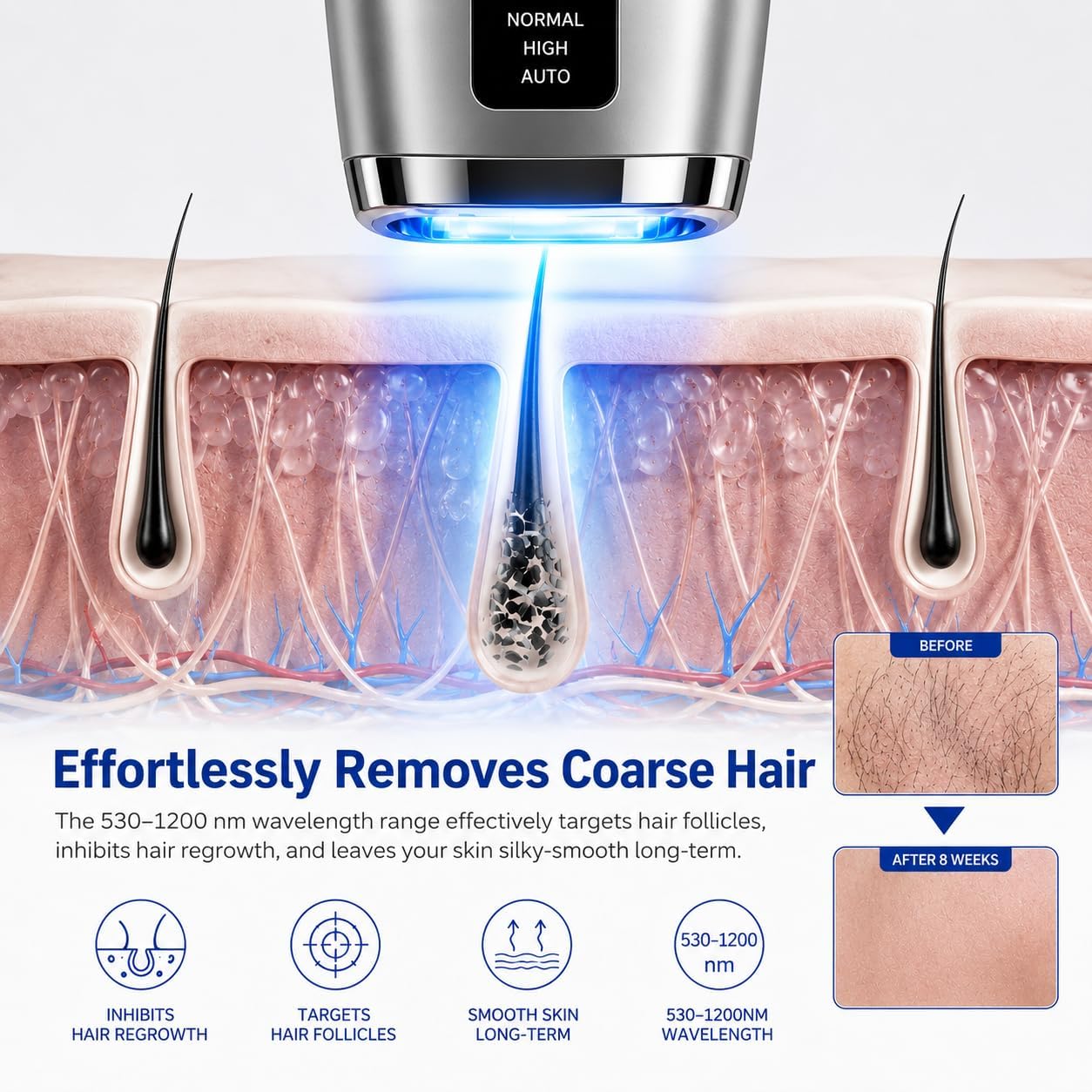 Thumbnail 2 de Mulbijeo Epilatore Luce Pulsata con Raffreddamento: depilazione domestica a 5°C, 9 livelli di energia