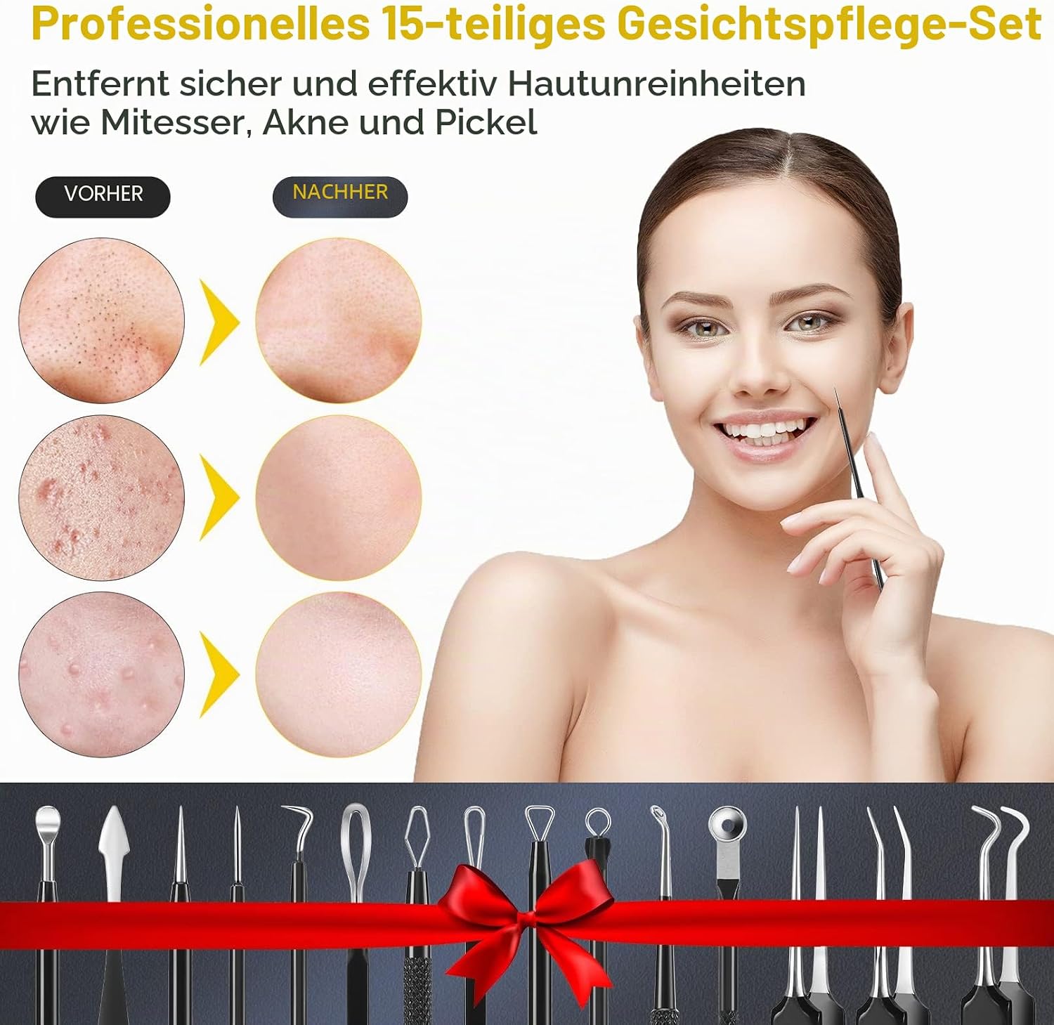 Thumbnail 4 de IUMAKEVP Mitesserentferner Komedonenquetscher Set 15-tlg