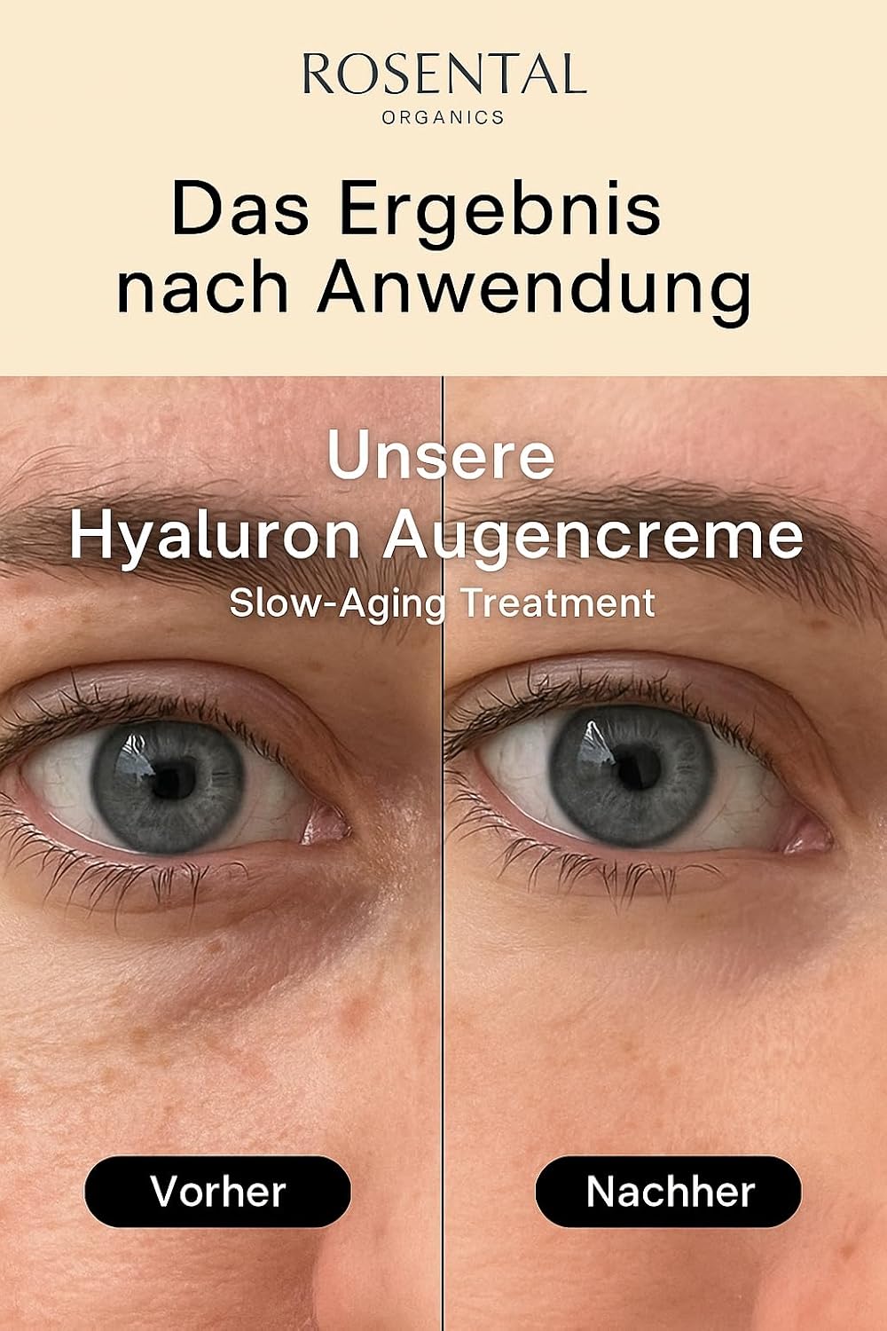 Thumbnail 3 de Rosental Organics Hyaluron Eye Balm (15 ml) – Anti-Aging Augencreme mit Aloe Vera & Jojobaöl