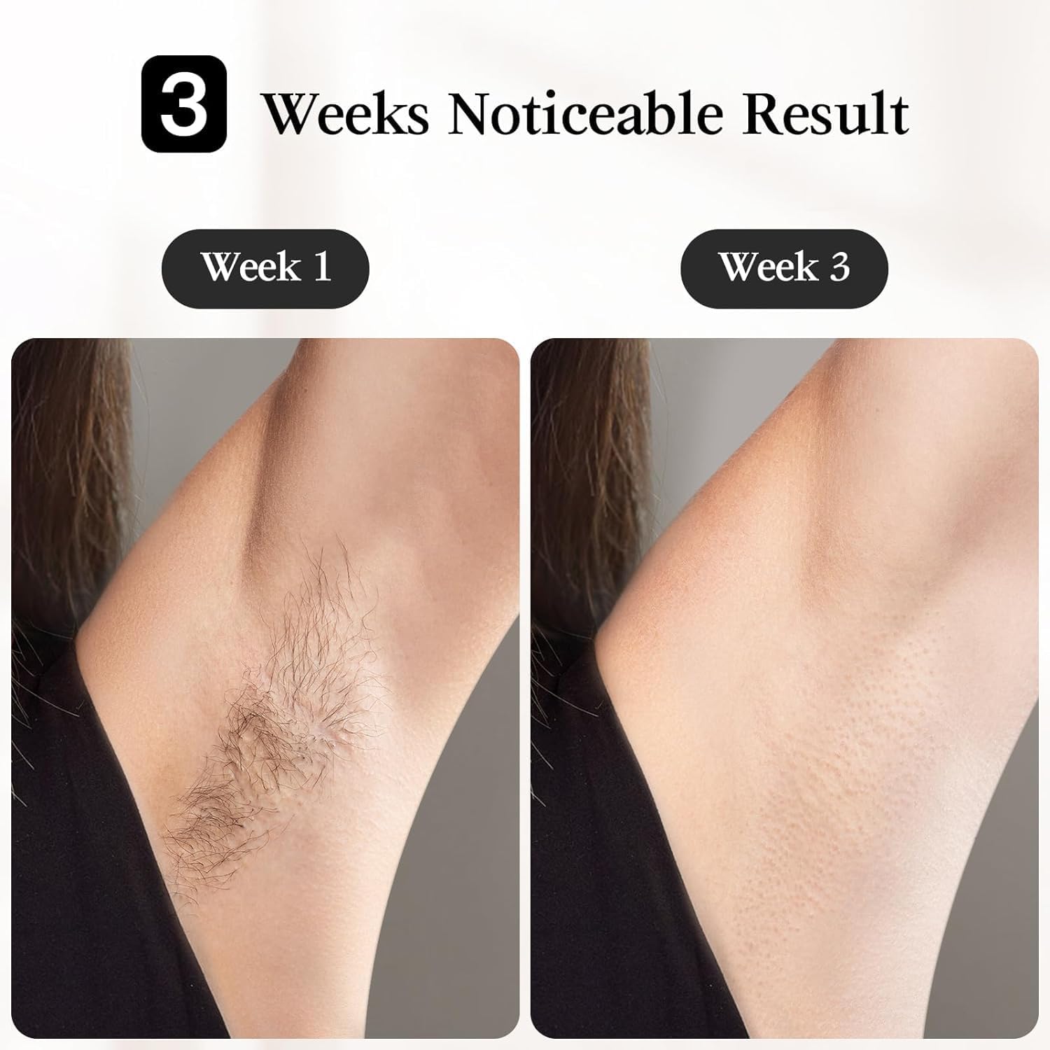 Detalle 2 de JOVS Laser Hair Removal IPL Device with 37°F Sapphire Cooling, 6 Modes, 330° Rotating Head