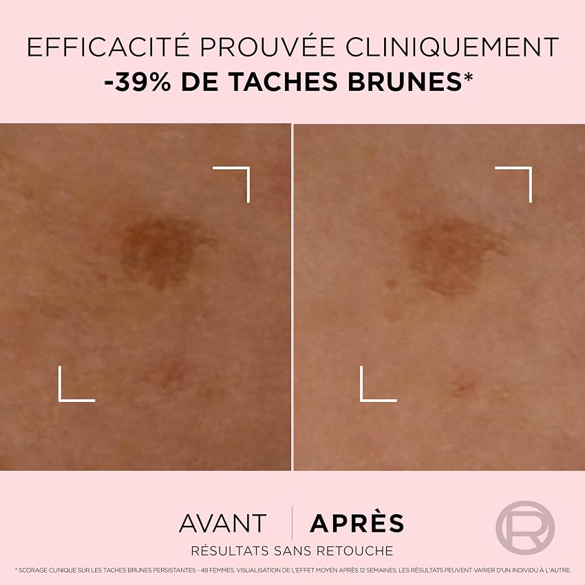 Thumbnail 4 de L'Oréal Paris Age Perfect Golden Age Sérum Correcteur Taches Brunes 30ml ⚙