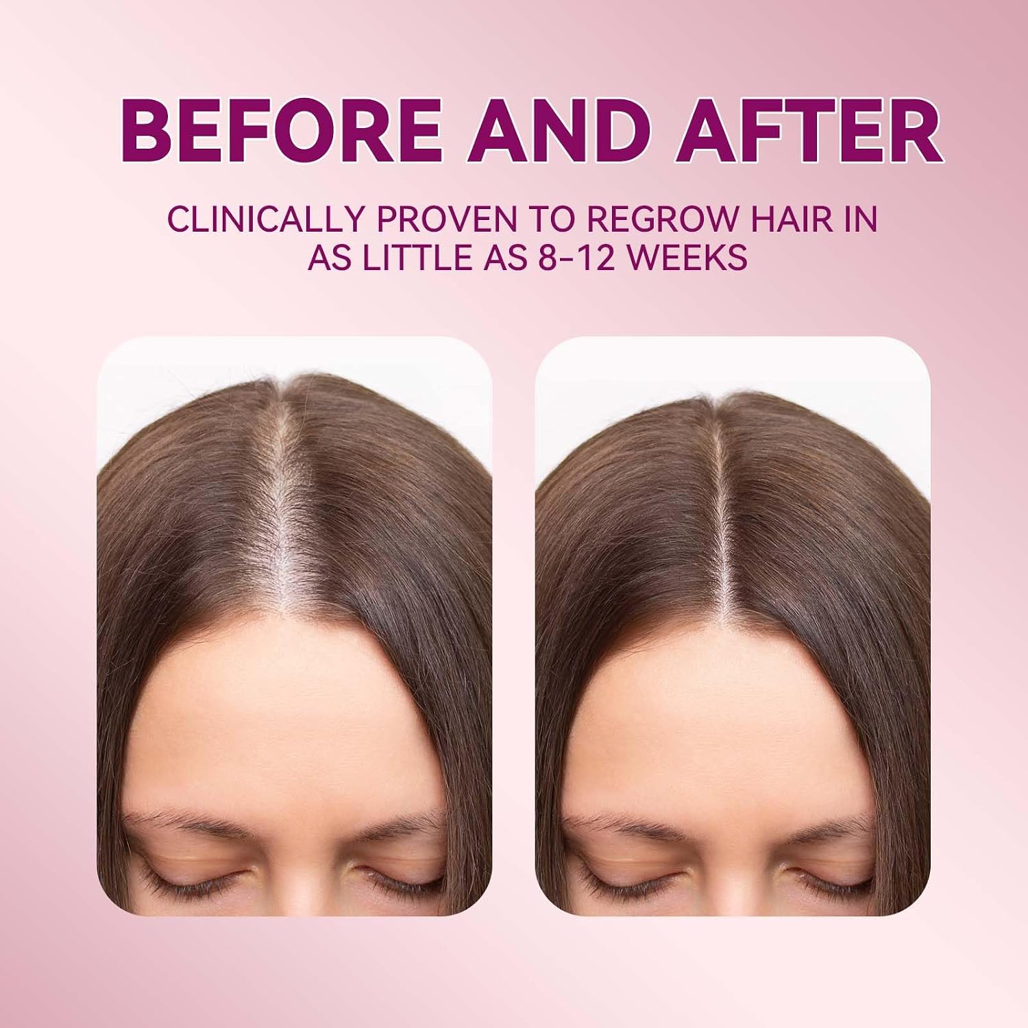 Detalle 2 de Lavtek 5% Minoxidil Hair Growth Serum for Women with Biotin & Castor Oil