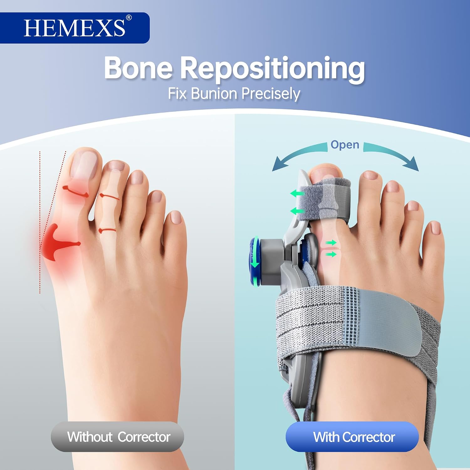 Thumbnail 5 de Bunion corrector with adjustable knob