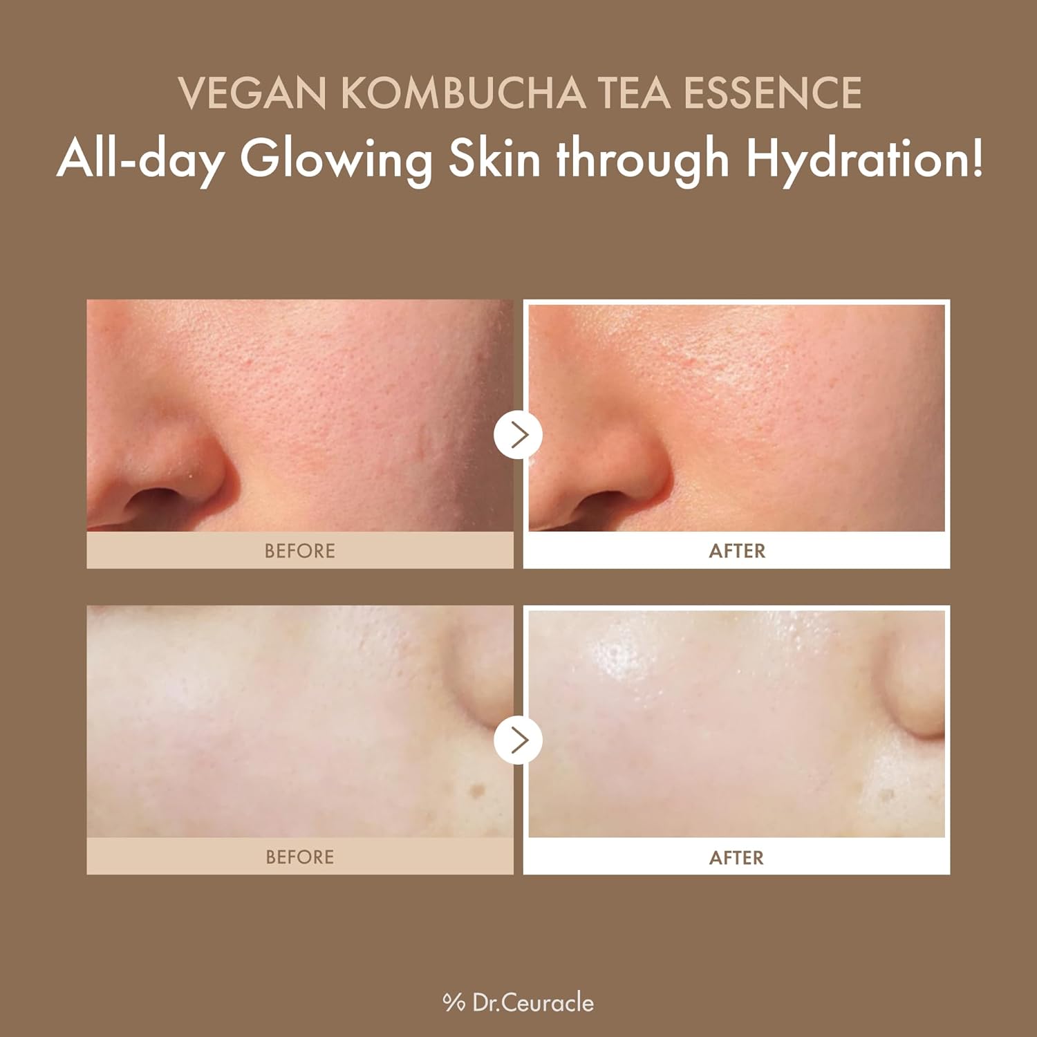 Detalle de Dr.Ceuracle Kombucha Toner 150ml