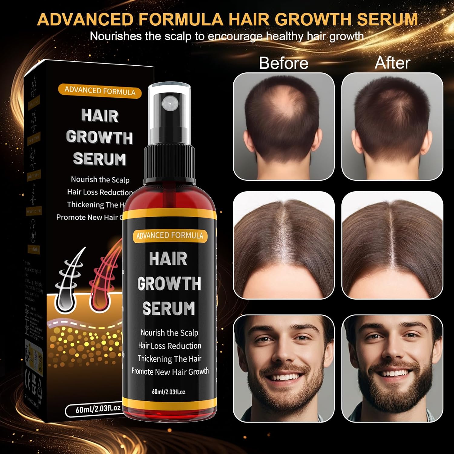 Detalle 2 de Haarwachstumsserum Spray für Männer &, Frauen – sanftes, nicht fettendes Haaröl mit Biotin und Rosmarin (60 ml)