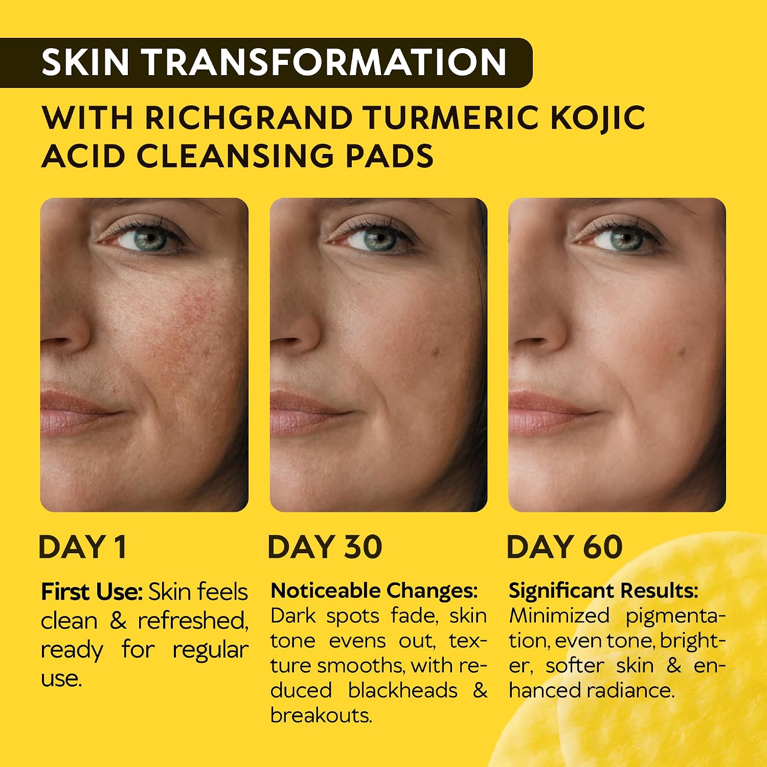 Thumbnail 1 de RICHGRAND Turmeric Kojic Acid Cleansing Pads, 50-Count Foaming Facial Wash