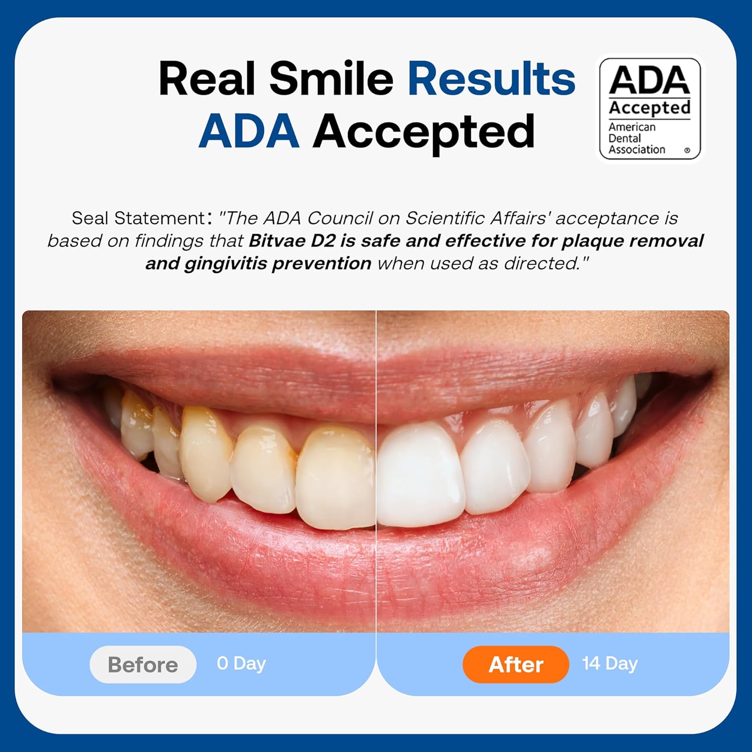 Detalle de Bitvae ADA Accepted Electric Toothbrush 60-Day