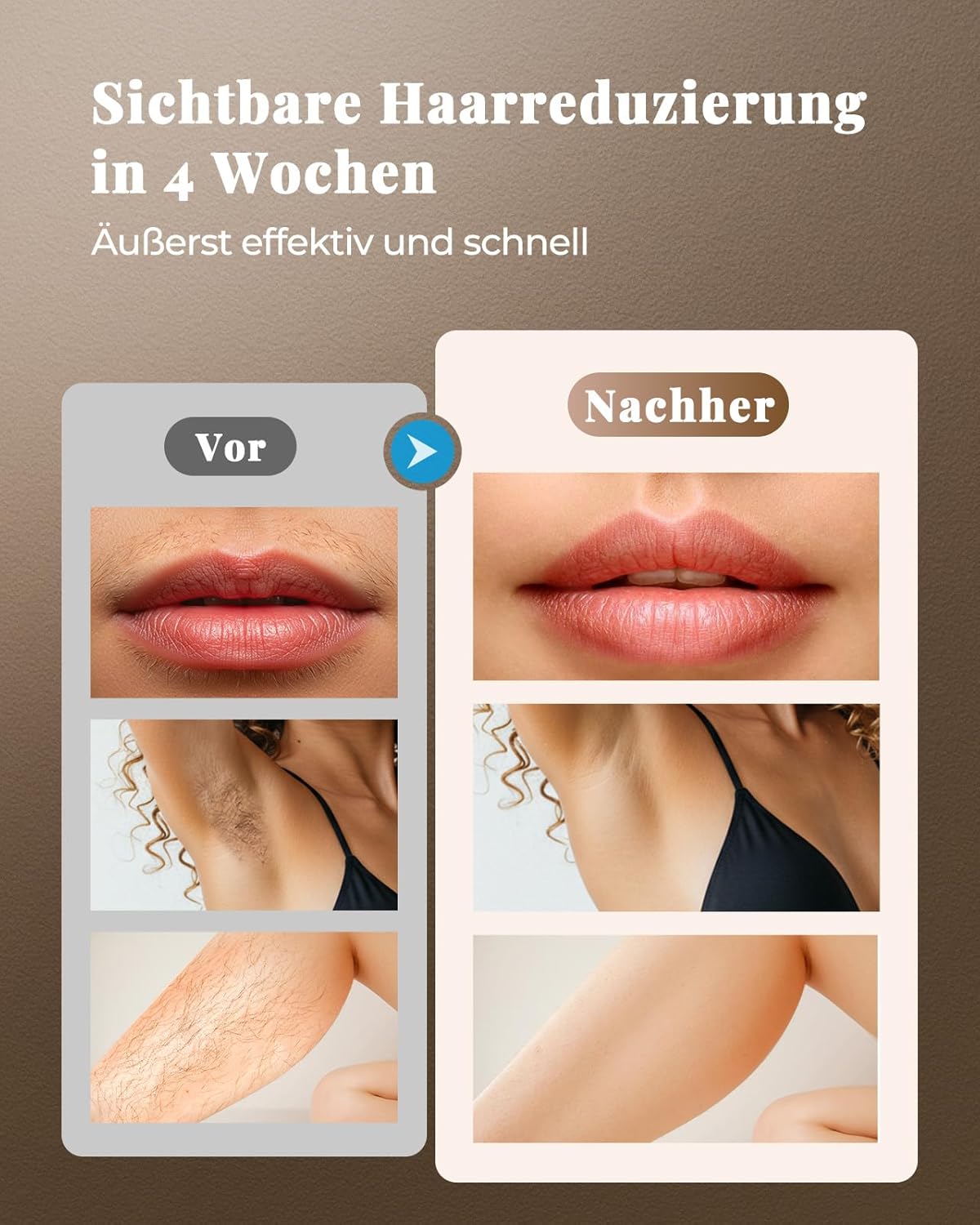 Thumbnail 1 de TIIMAGIC IPL Haarentfernungssystem 3-in-1 – Schnelle, schmerzfreie Ganzkörperbehandlung zu Hause