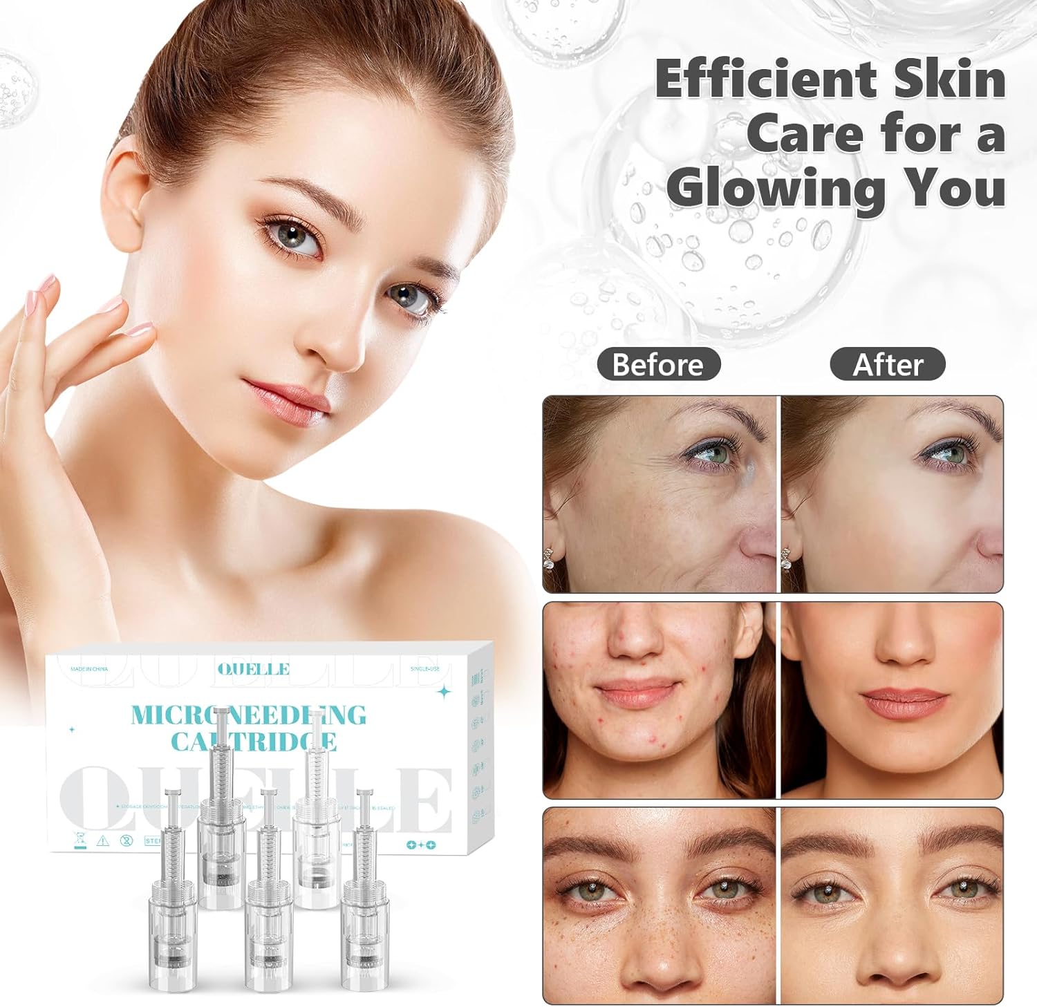 Detalle de 10 Aghi Dermapen 24 Pin – Cartucce di ricambio universali con porta filettata per pen microneedling