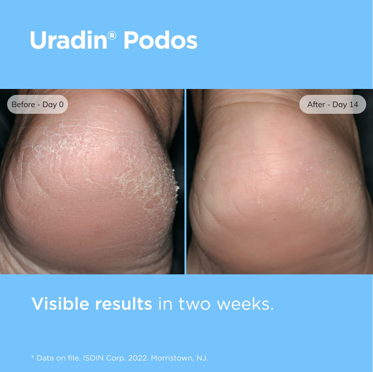 Thumbnail 4 de ISDIN Uradin Podos Gel Oil 10% Urea Foot Cream