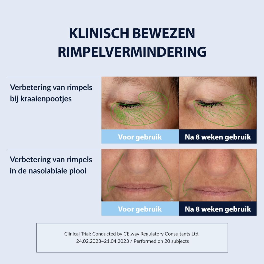 Thumbnail 3 de MIZON Retinol Youth Cream 0,3% gezichtscrème met peptiden en bakuchiol