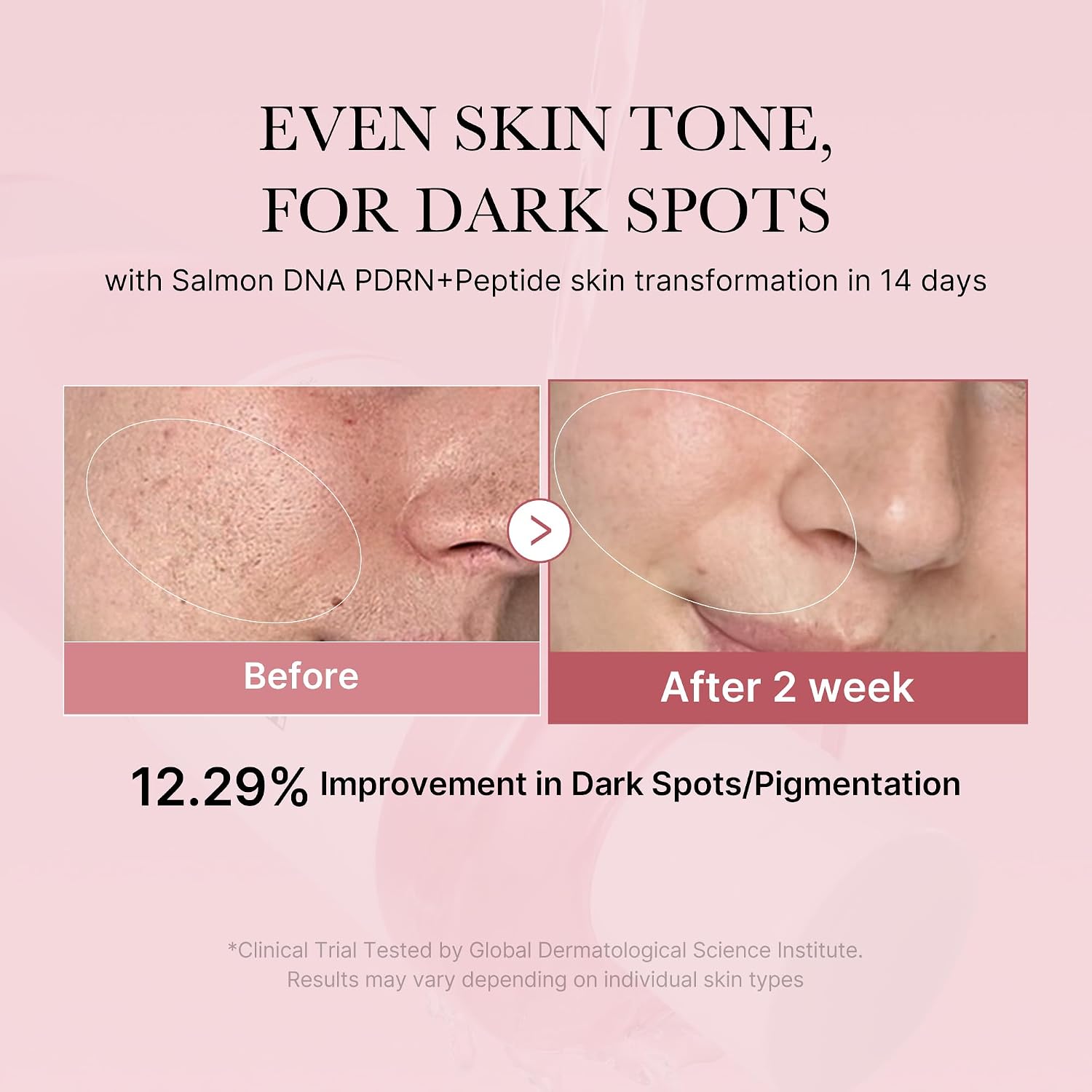 Detalle de medicube Salmon DNA PDRN Pink Cica Soothing Toner (250 ml) – beruhigendes Tonikum für empfindliche Haut
