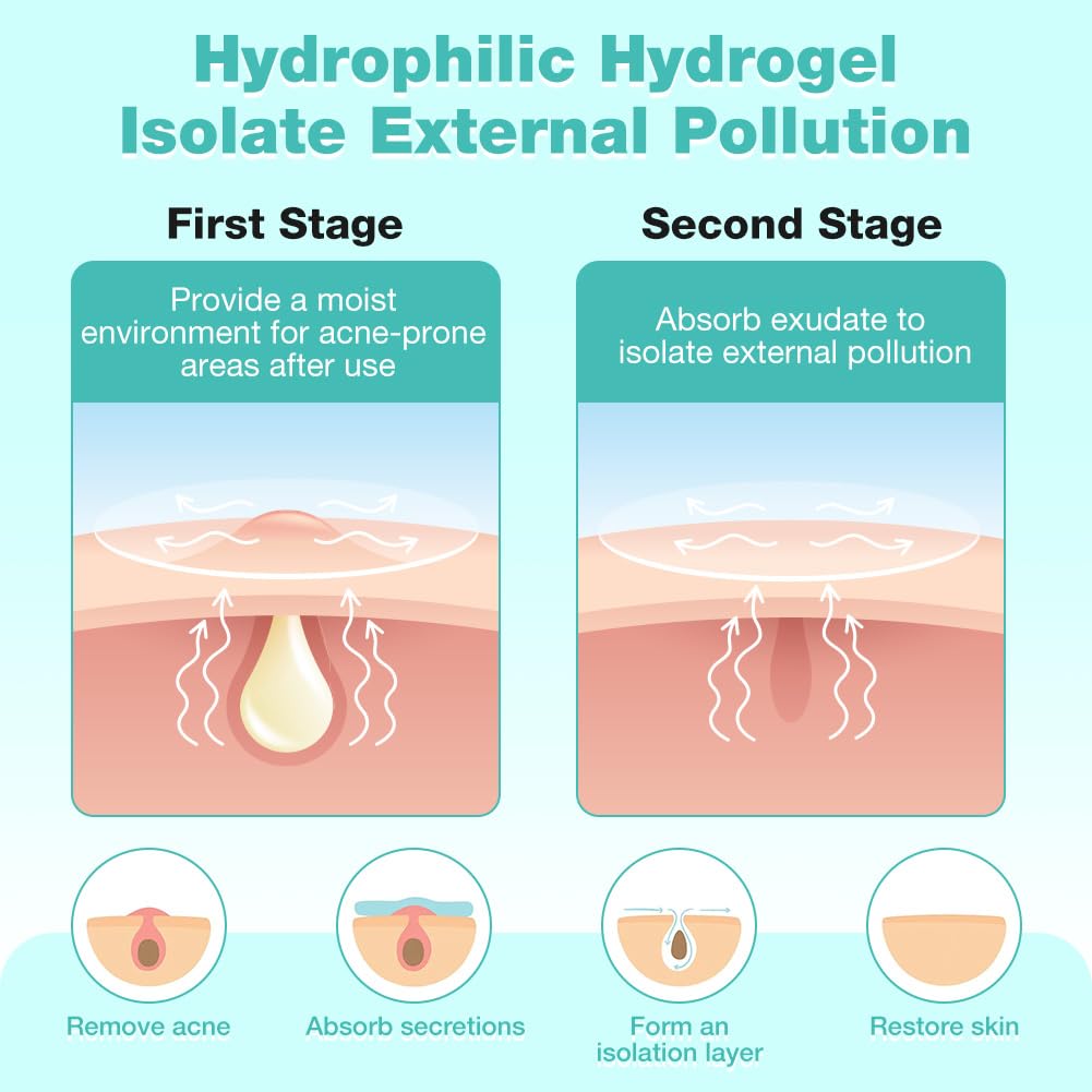 Thumbnail 6 de BUTBU 400 Sternförmige Pimple Patches – Hydrokolloid, 2-in-1 Akne Pflaster mit Salicylsäure, Teebaumöl & Centella Asiatica
