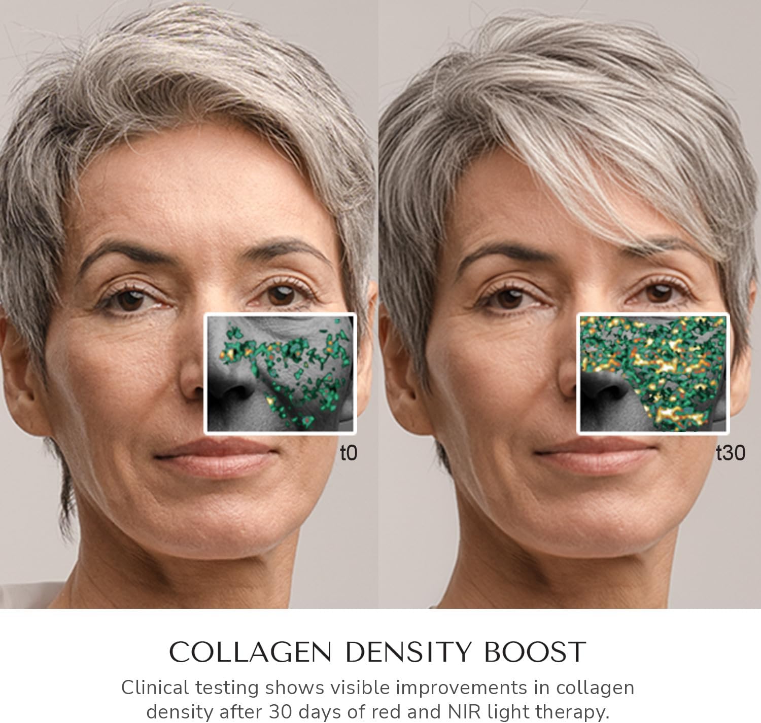 Detalle de ODELYNE Adara masque facial 288 LED 🧖